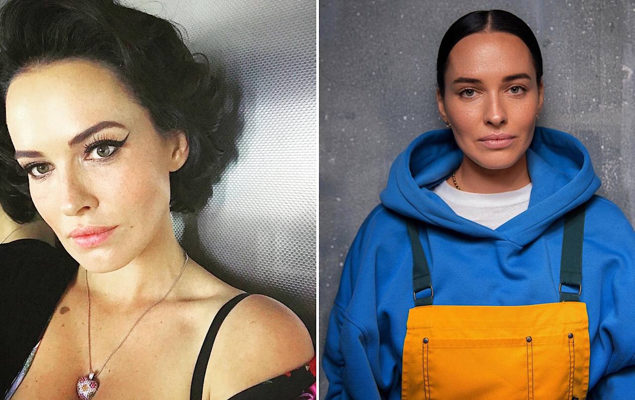 Фото Лесі Нікітюк, Наді Дорофєєвої та інших зірок до та після збільшення губ