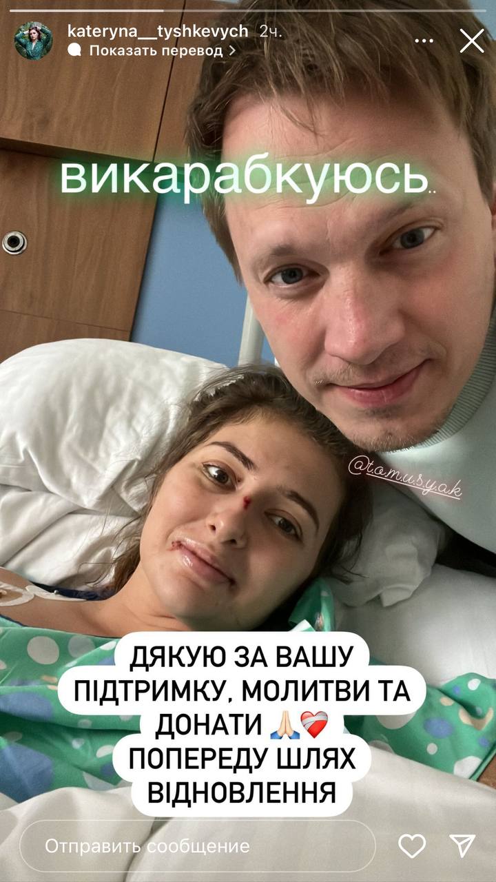 Тяжелобольная Тишкевич после реанимации и терапии показала, в каком состоянии находится сейчас (фото)