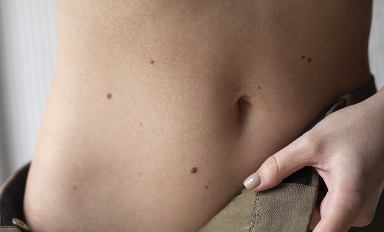 &quot;Поціловані&quot; щастям: ці родимки на тілі та обличчі приносять удачу