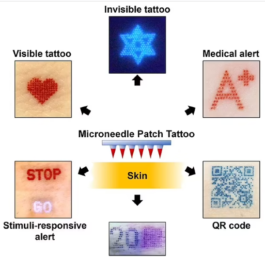 Вчені винайшли пластир, яким можна робити татуювання за лічені хвилини: як він виглядає