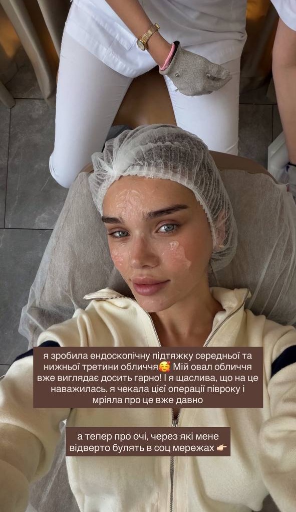 Саша Бо поскаржилася на ускладнення після омріяної &quot;пластики&quot;: фото до та після