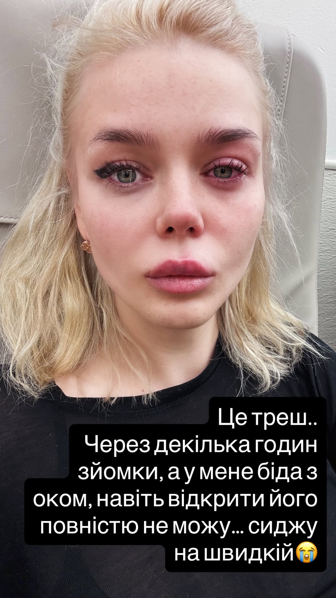 Аліна Гросу раптово опинилася у лікарні (відео)