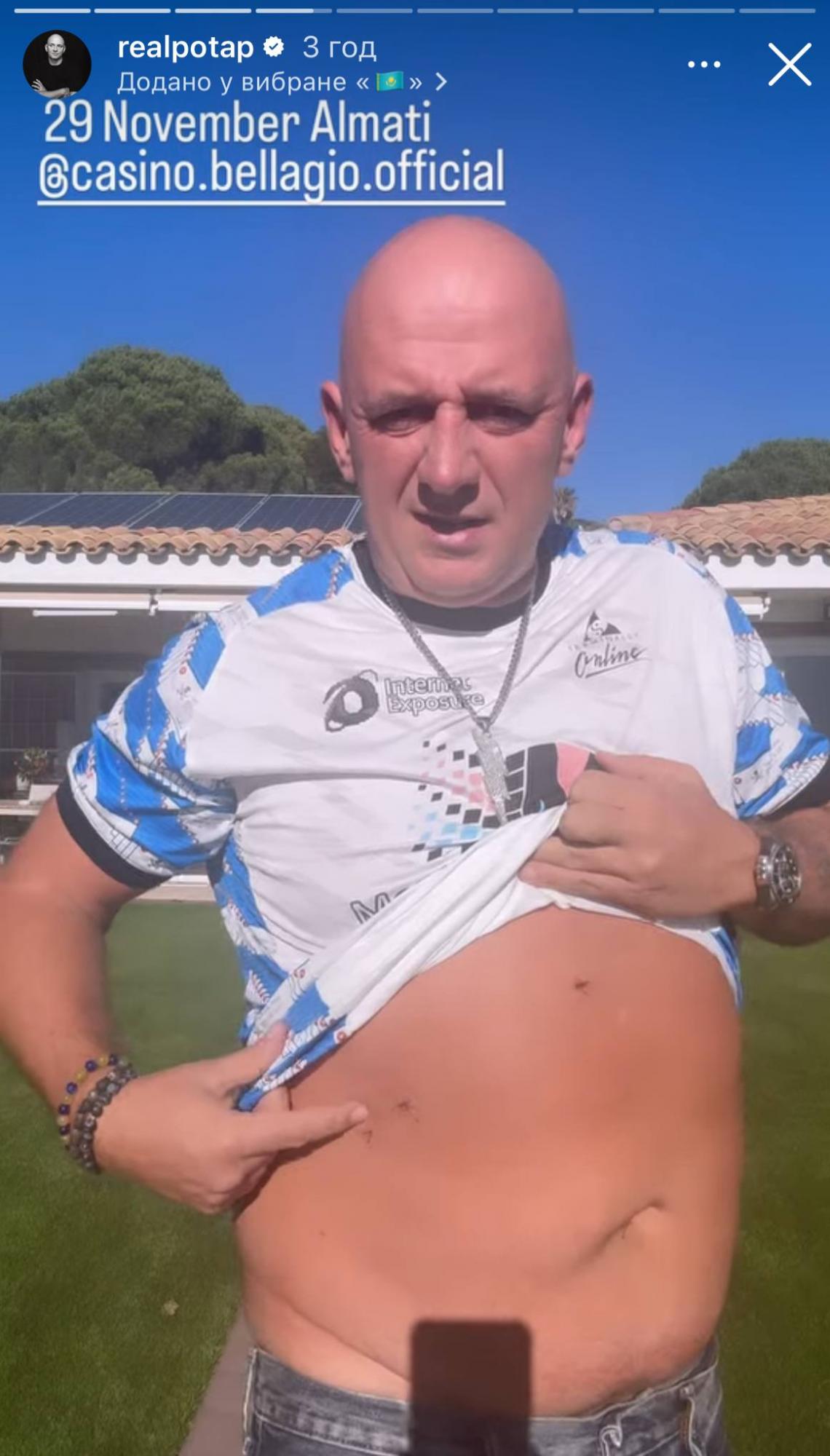 Потап переніс важку операцію і показався у лікарні (фото)