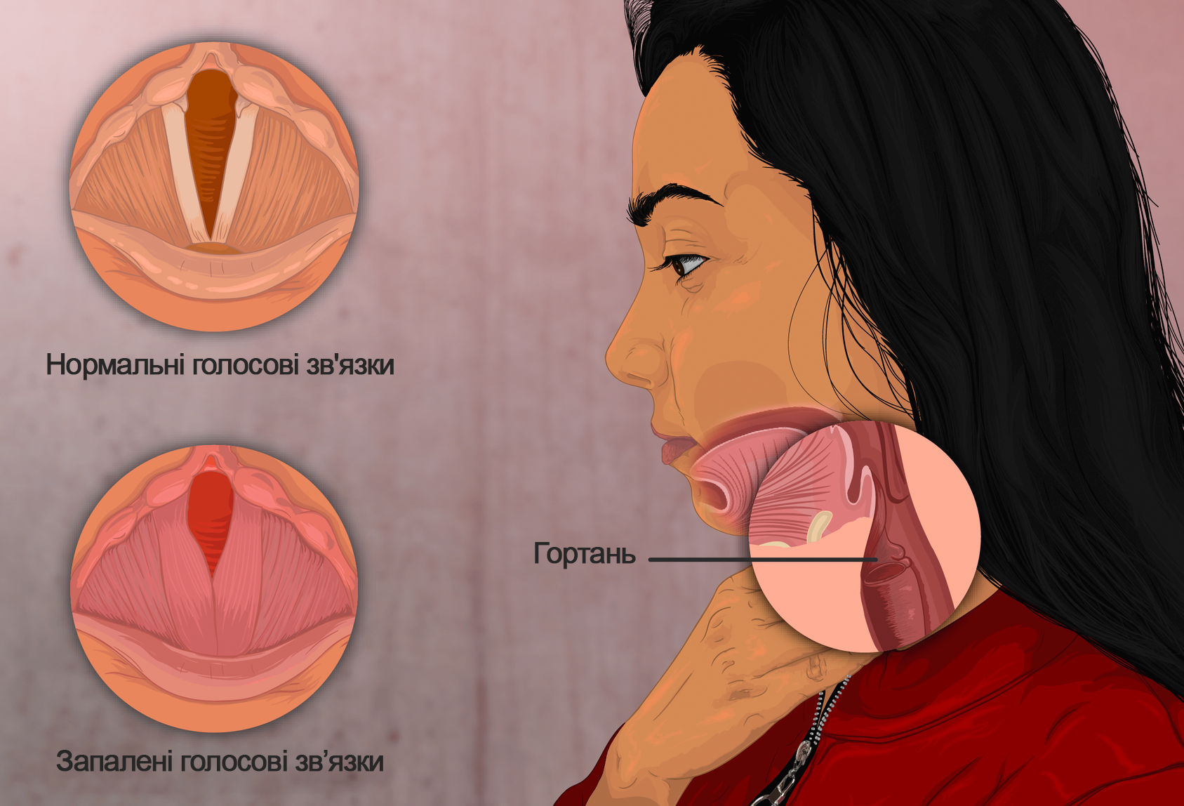 Олег Винник серйозно захворів. На одному концерті за кулісами він впав