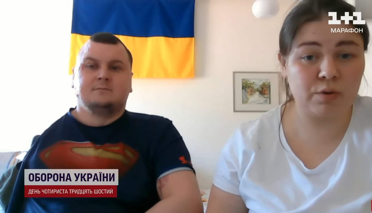 &quot;Боялися, що розсиплеться&quot;: лікарі врятували бійця ЗСУ з опіками, для яких немає класифікації