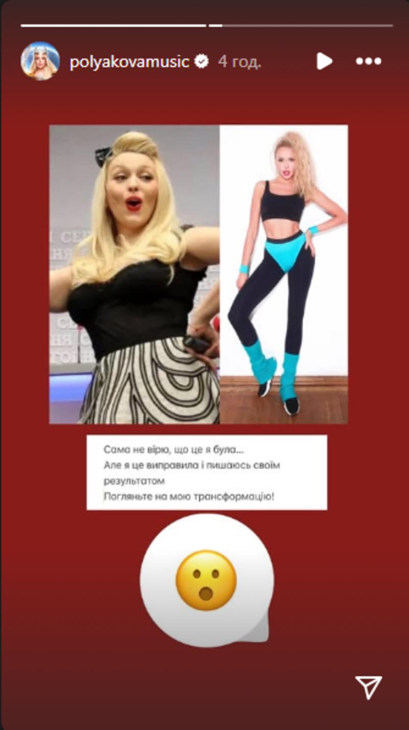 &quot;Сама не верю, что это была я&quot;. Полякова показала, как выглядела в своем самом большом весе