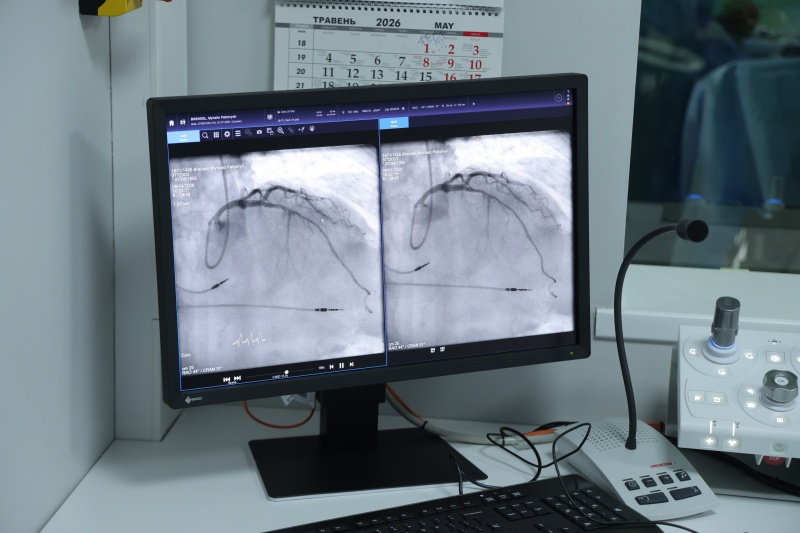Инфаркты – проблема "номер один" в Украине. Они бывают и в 25: интервью с Георгием Маньковским