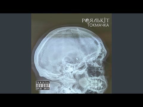 "Уламок потрапив у мозок": український музикант розповів про поранення на фронті