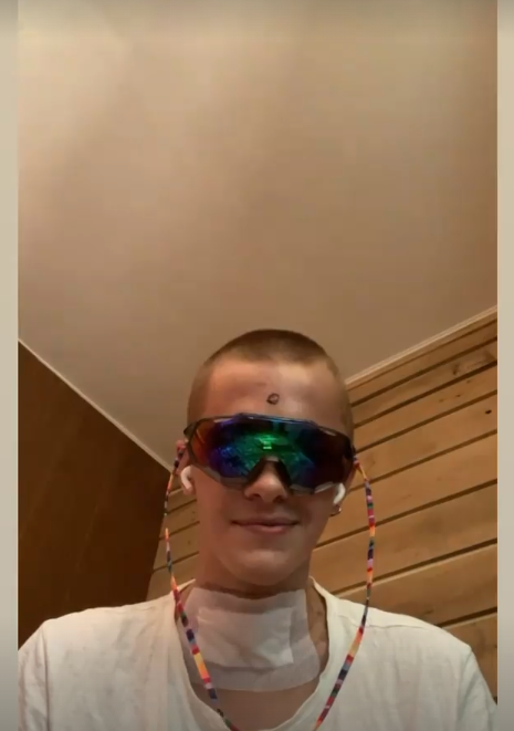 Побитий танцівник Дорофєєвої відповів хейтерам, які бажають йому смерті (фото)