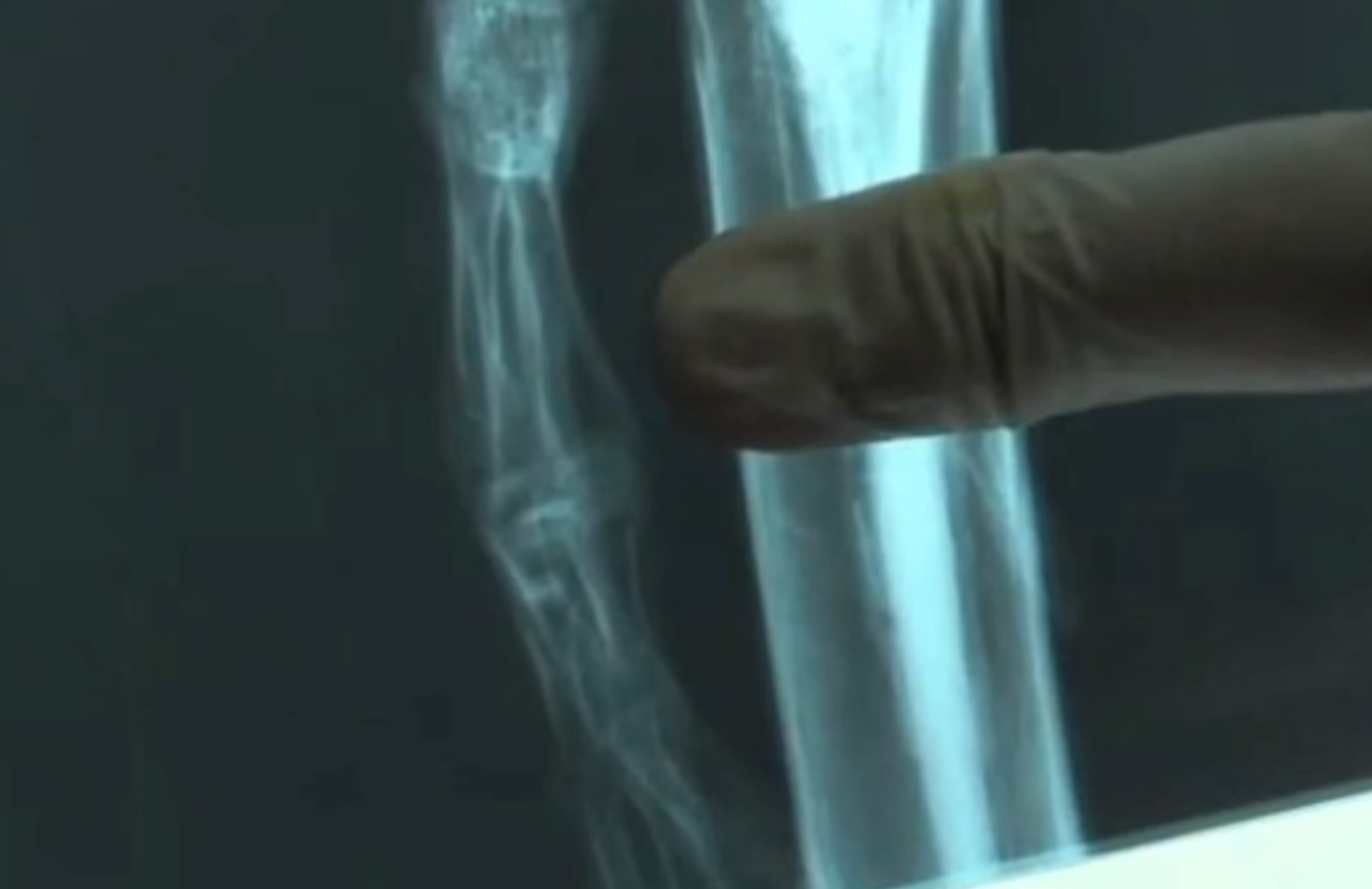 &quot;Гуманоид Атакамы&quot;. Как выглядит загадочная крошечная мумия, найденная учеными, и что о ней известно