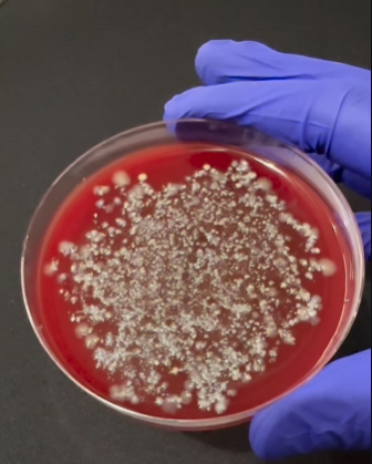 Сколько микробов на суши. Ученый показал то, что трудно &quot;развидеть&quot; (видео)