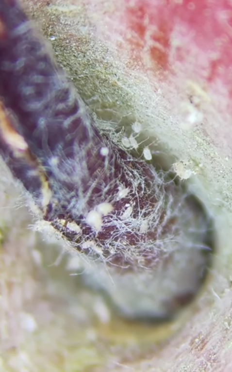 Як виглядає яблуко під мікроскопом і хто там живе. Це важко розбачити