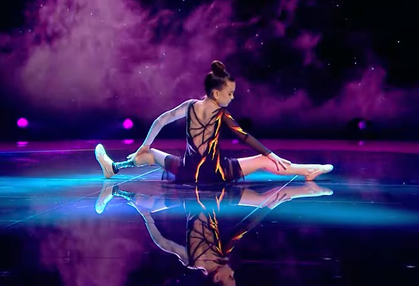 Враг искалечил, но не сломал. Как сегодня живет 7-летняя гимнастка с протезом Саша Паскаль: сильные фото