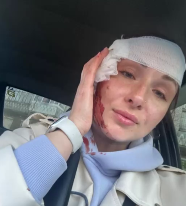 Ракетные атаки на Запорожье. Под удар попала журналистка (фото)