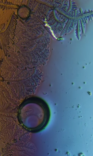 Как выглядит слеза под микроскопом. Такого вы точно не ожидали (видео)