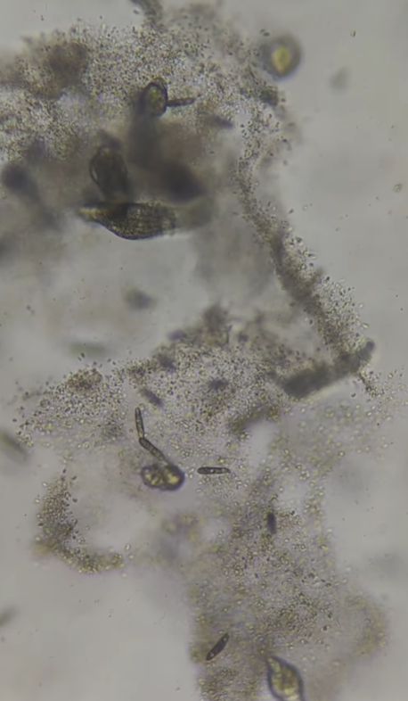 Воду з-під крана показали під мікроскопом, але найбільш &quot;цікавеньке&quot; помітили на аераторі (відео)