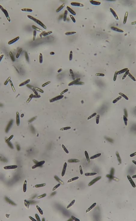 Воду з-під крана показали під мікроскопом, але найбільш &quot;цікавеньке&quot; помітили на аераторі (відео)