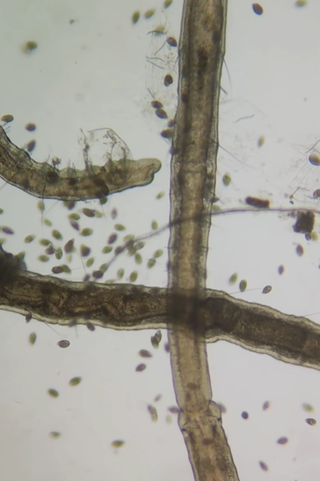 Воду з-під крана показали під мікроскопом, але найбільш &quot;цікавеньке&quot; помітили на аераторі (відео)