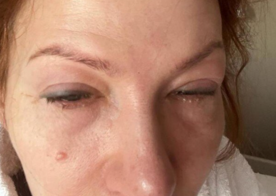 Распухло лицо, все время мучается. Что произошло со звездой &quot;Маски-шоу&quot;, предавшей Украину