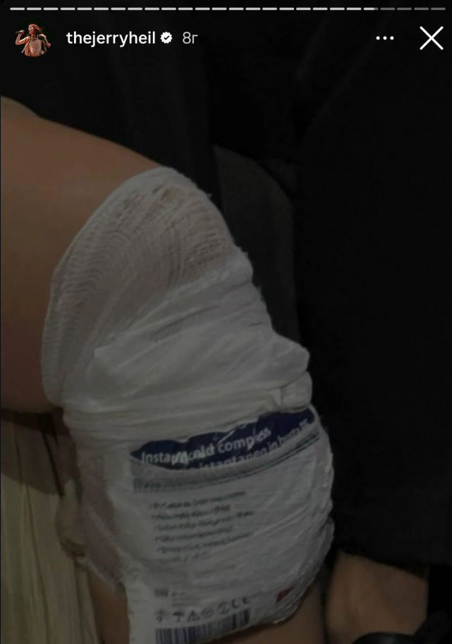 Євробачення 2024. Jerry Heil отримала травму під час виступу (фото й відео)