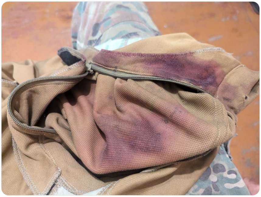 Журналіст і колишній політв'язень Кремля Станіслав Асєєв отримав поранення на фронті