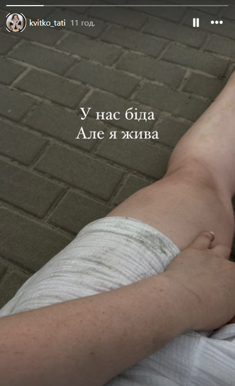 &quot;Не все живы&quot;: участница &quot;СуперМамы&quot; сообщила о потере родного человека из-за пожара в доме