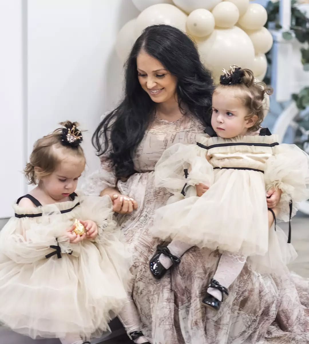 Українка народила зрощених близнюків, яким давали мінімальні шанси вижити: як вони виглядають зараз