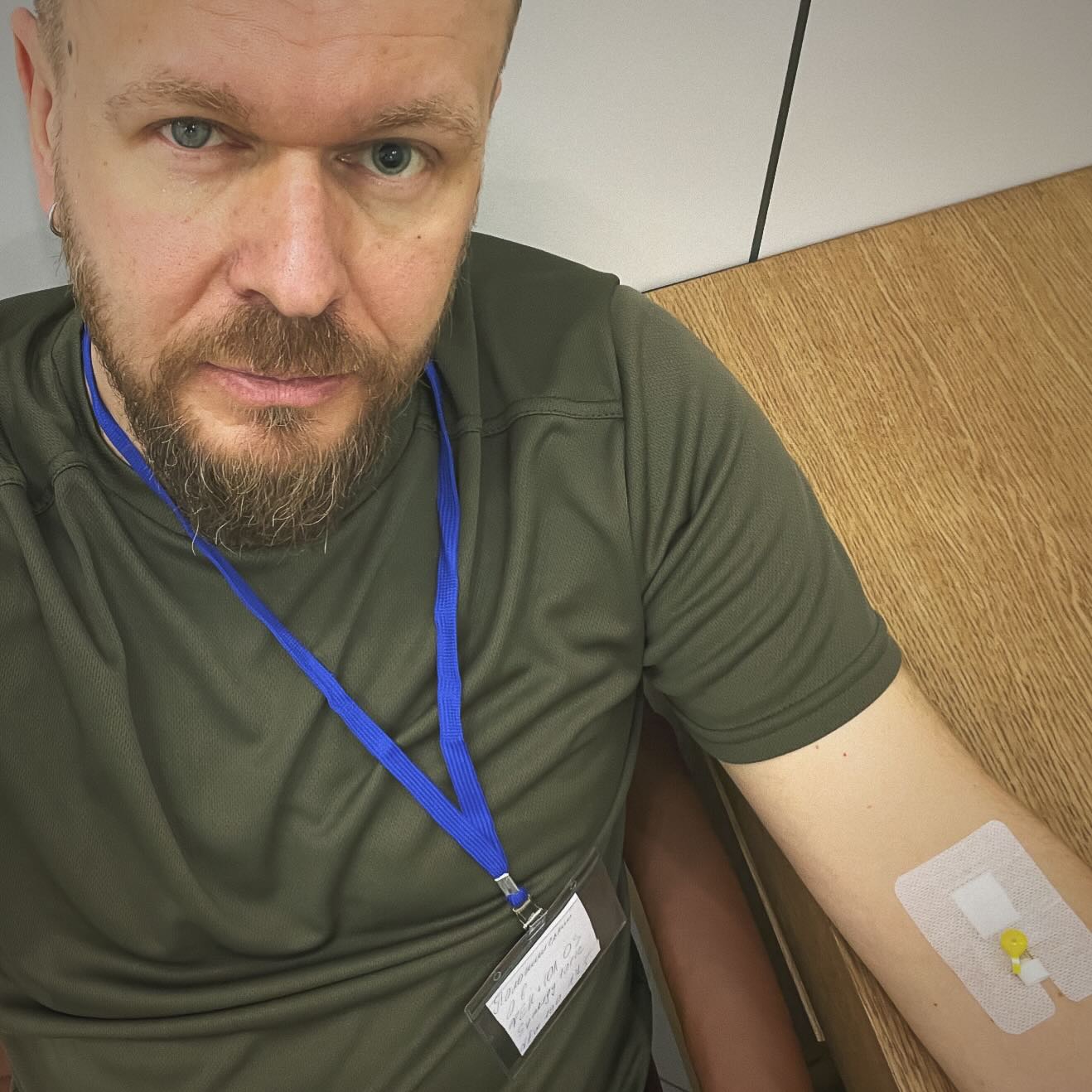 &quot;Що з вами робили?&quot;: Олександр Положинський налякав виглядом своїх очей під крапельницею