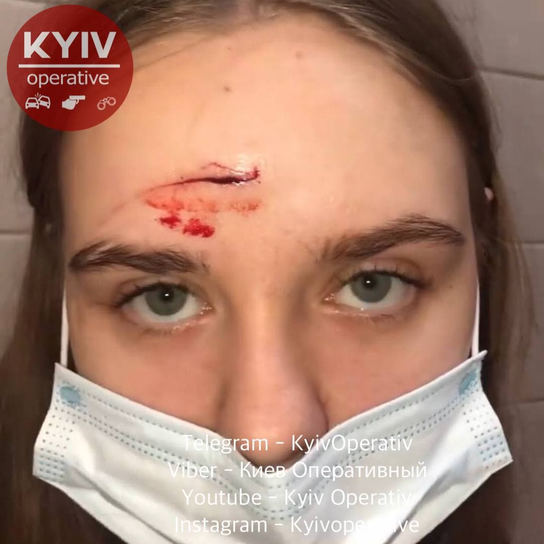 У київському ТЦ жорстоко побили дівчину: &quot;ти ще від мене тікати будеш&quot;