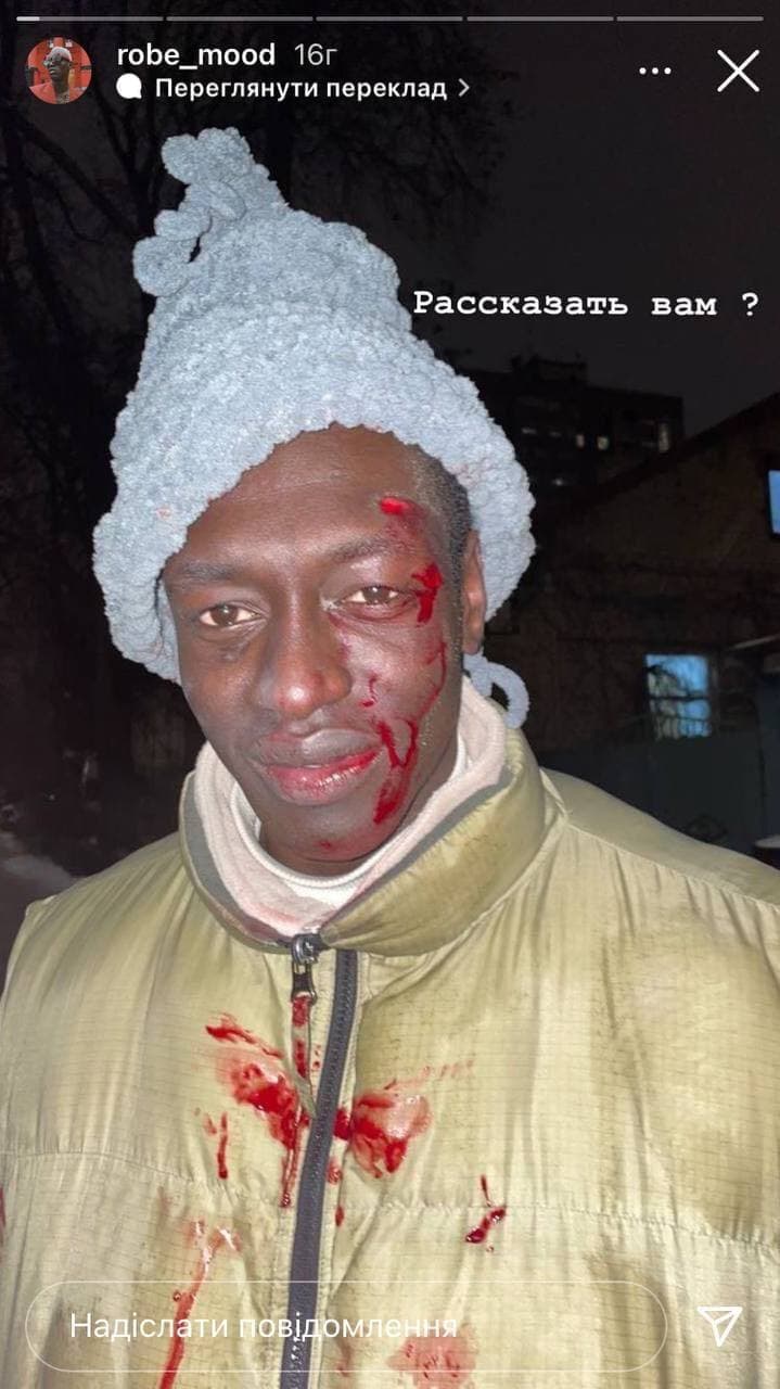 В Киеве таксист избил до крови темнокожего пассажира: детали  вопиющего случая