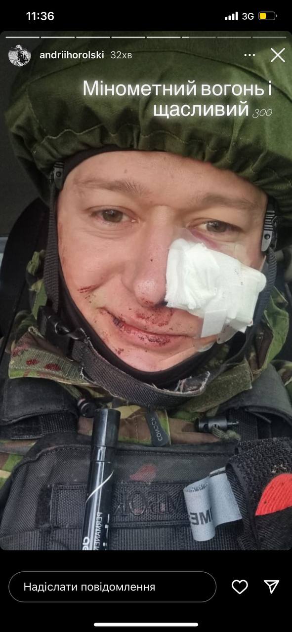 Андрій Хливнюк потрапив під мінометний обстріл: його поранено