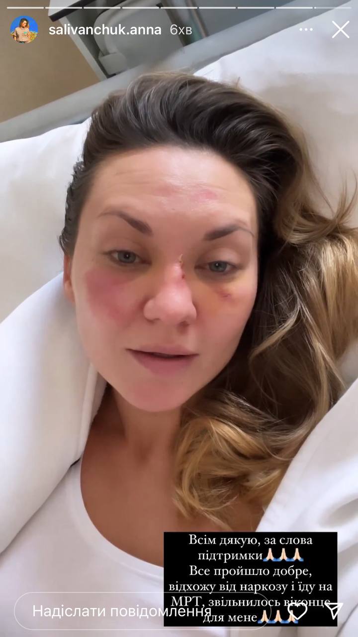 &quot;В моей голове два затемнения&quot;: актрисе Саливанчук после ужасного падения сделали операцию
