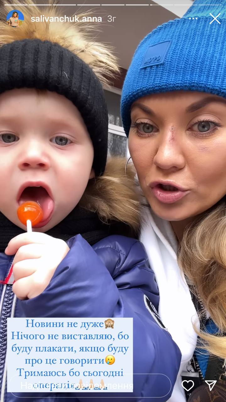 &quot;В моей голове два затемнения&quot;: актрисе Саливанчук после ужасного падения сделали операцию