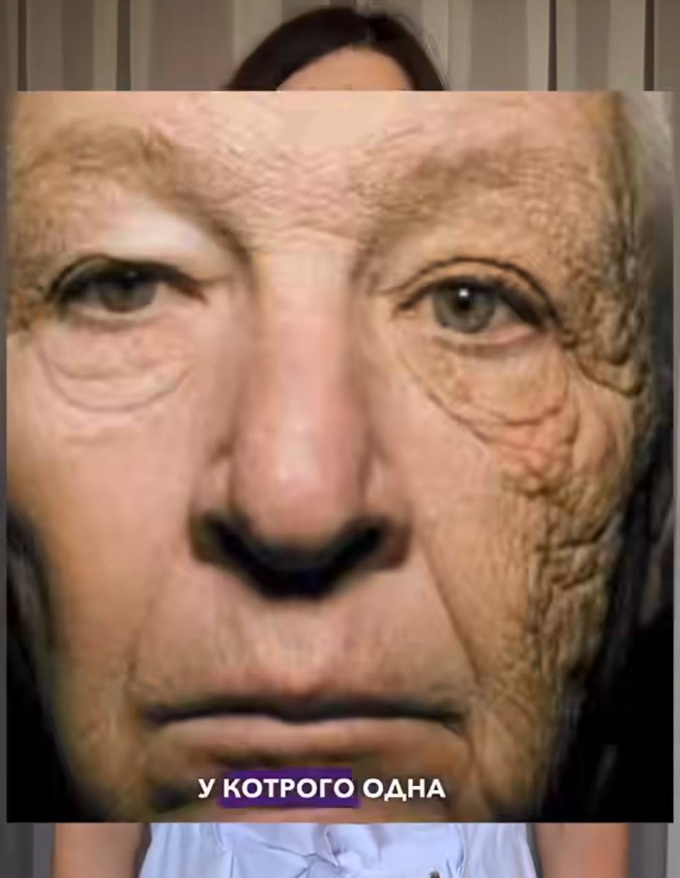 Що станеться з шкірою, якщо не користуватись SPF-кремом восени: фотоприклади