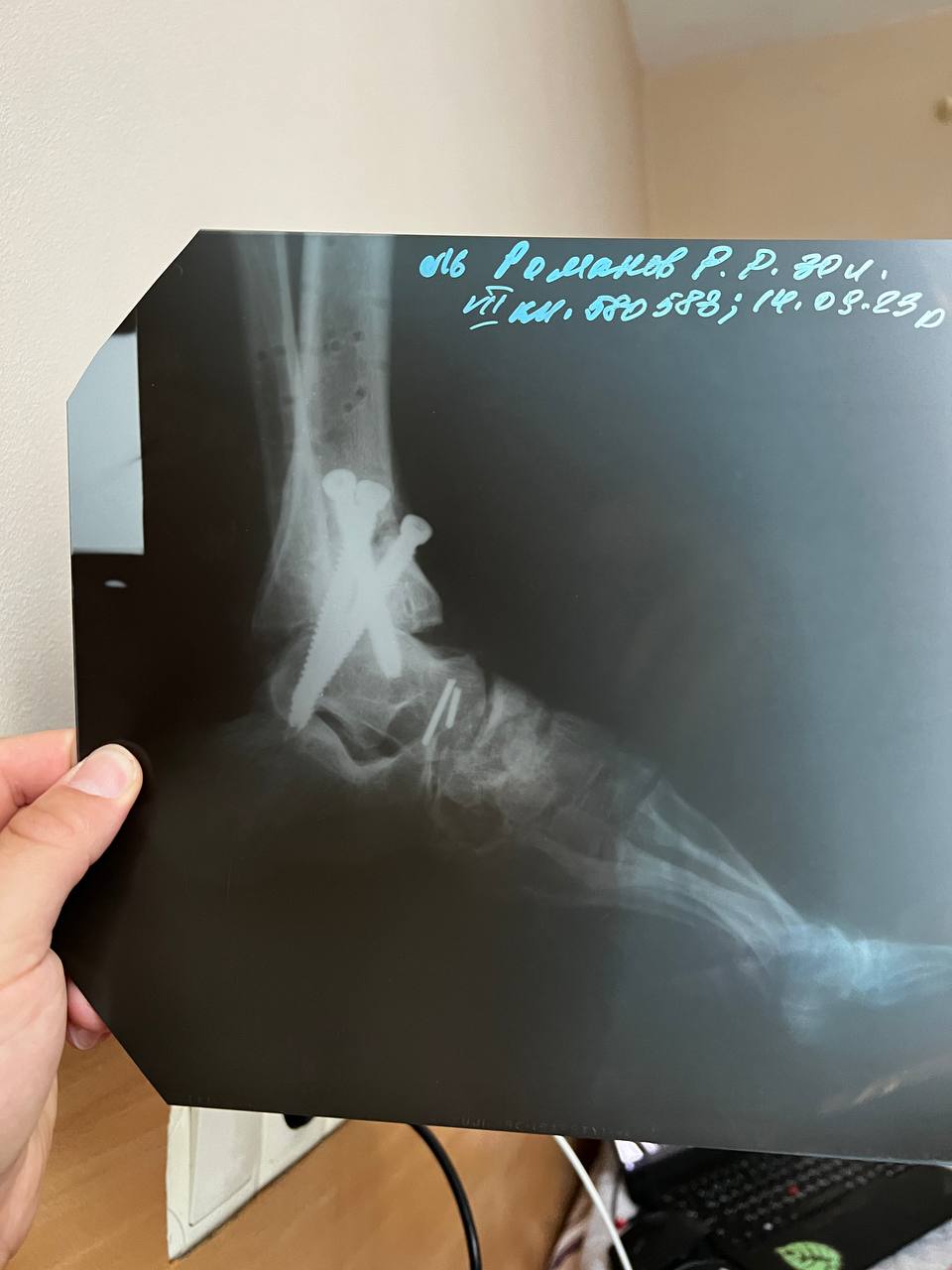 'Russia wants us to leave our country and forget our history' - Ukrainian military volunteer miraculously survives injury