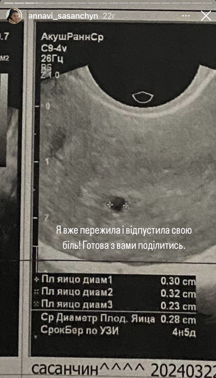 &quot;Болело все&quot;: жена Романа Сасанчина заявила о трагической потере