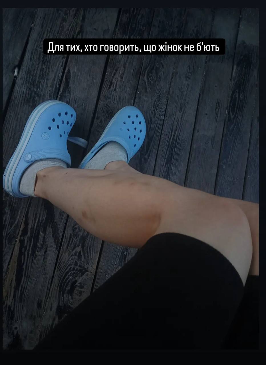 Освобожденная из плена следователь Марьяна Чечелюк впервые за два года увидела маму: щемящее видео до слез