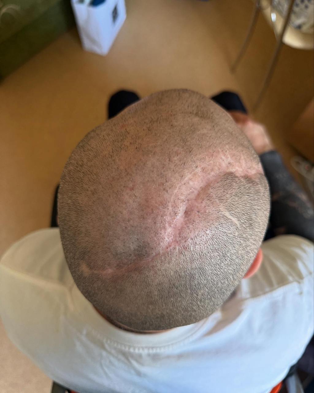 Розовий з &quot;Ліги сміху&quot; зізнався, як живе після важкого поранення: &quot;Думали, що не протягну і 10 днів&quot;