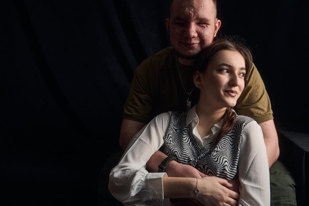 &quot;Невеста поддерживает с первых дней&quot;. Чувственная история Влада, потерявшего глаза, защищая Украину