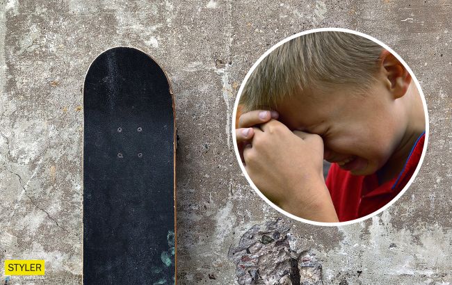 У Тернополі мати побила скейтом 10-річного сина: у дитини множинні забої голови