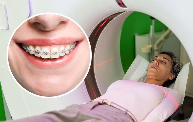 Можно ли делать МРТ с брекетами: ответ врача