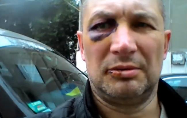 "Кожен день приходить і плює": у Криму побили українця через символіку на авто