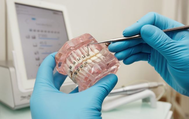 Брекети після 30: чому ніколи не пізно подбати про усмішку