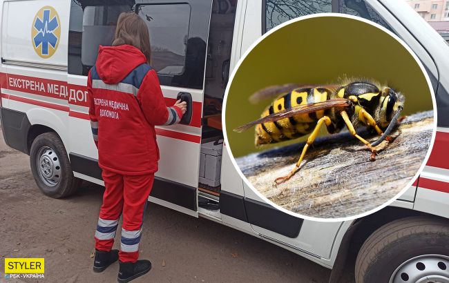 Укусила оса, пчела или шершень: как быстро оказать первую помощь