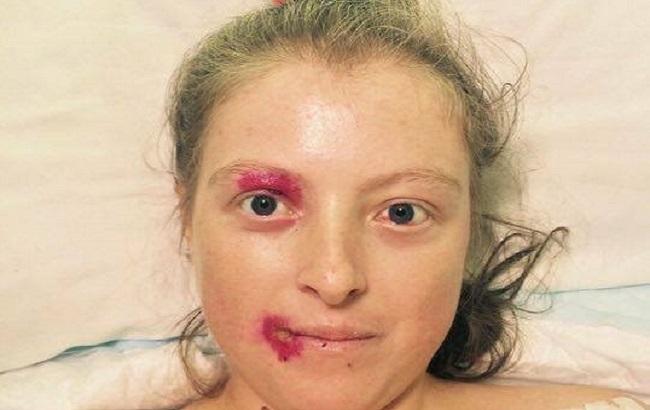 Из-за реформы Минздрава 21-летняя украинка может умереть