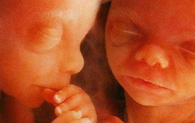 Народилися перші генетично модифіковані близнюкі