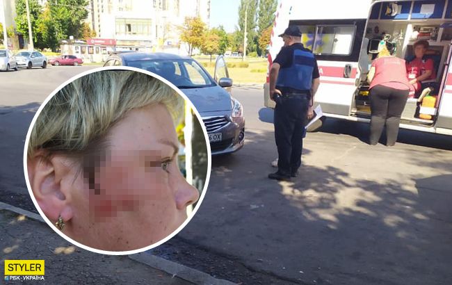 В Киеве водитель-мажорка избила продавщицу: в сеть попали фото