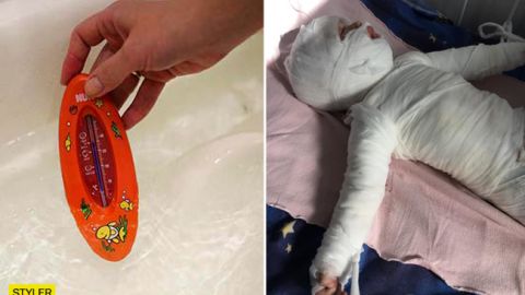 Под Одессой 11-месячного ребенка искупали в кипятке (видео)