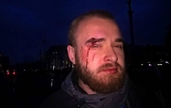 "Сволота наживається на війні": боєць АТО, якого побили в центрі Києва, опублікував фото нападника