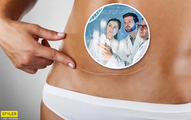 Кесарів розтин: вчені виявили ще один наслідок цієї операції